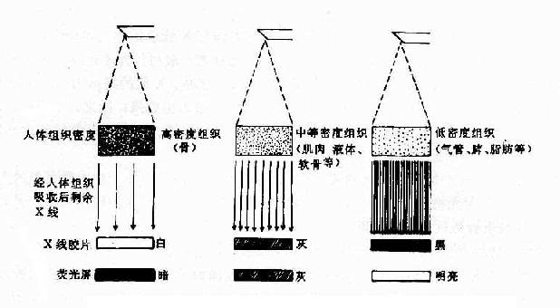 x射线工作原理是什么_白带是什么图片