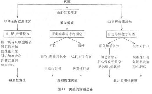 最新 黄疸的诊断与鉴别诊断