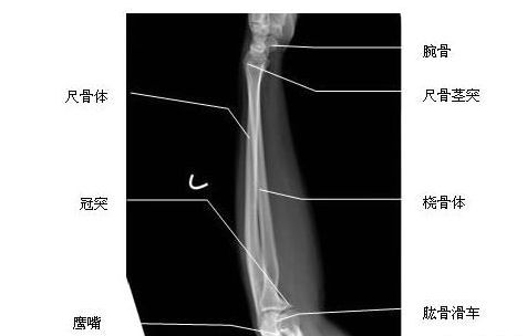 2014年实践技能医师医学影像学:尺桡骨侧位-x线