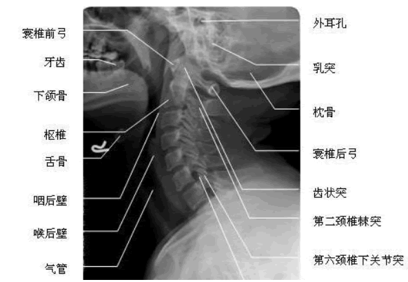 2016年医师实践技能考试识图-颈椎正侧位